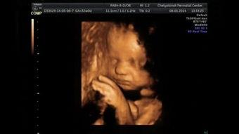 彩超视频,捕捉生命律动的瞬间